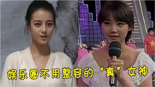 娱乐圈拒绝整容,坚守自然之美，传递正能量